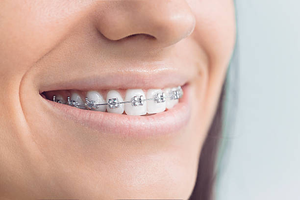 Best Dentures (Full and Partial)  in Lafayette, OR